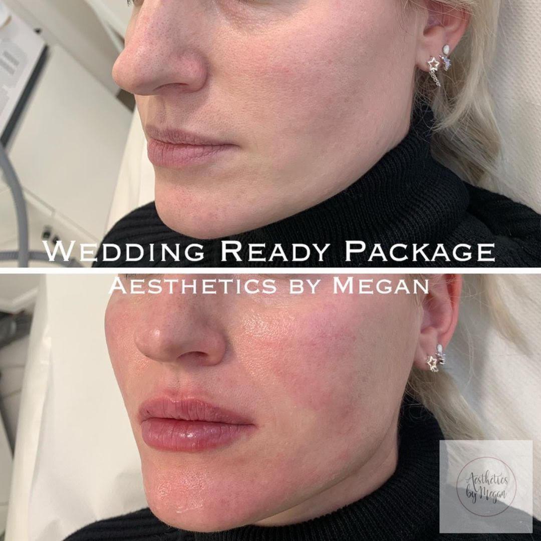 Be the best version of you on the biggest day of your life!